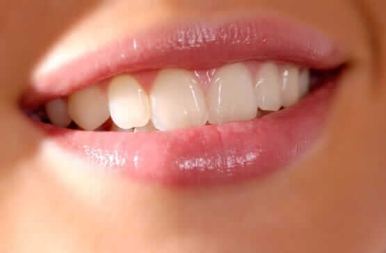 estética dental